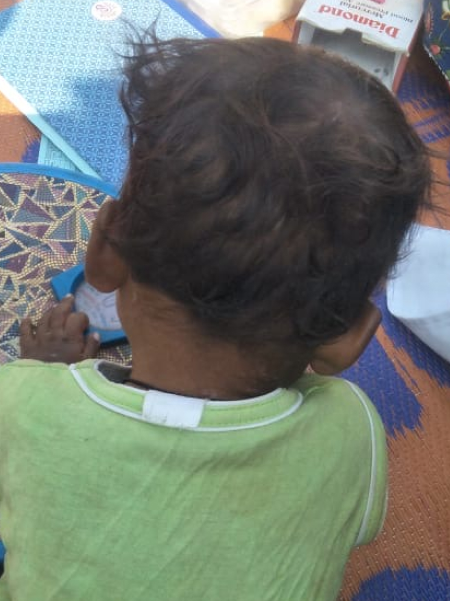 Chethina Recovery After Treatment