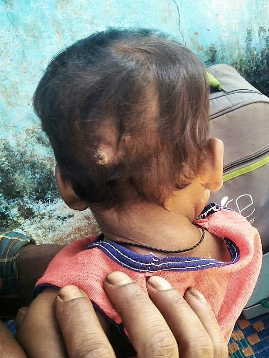 Chethina Allergy Before Treatment